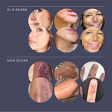 Daily Dose Scar Cream Serum